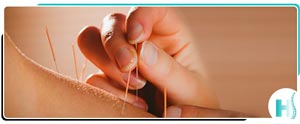 Acupuncture Therapy Near Me in Hoboken, NJ