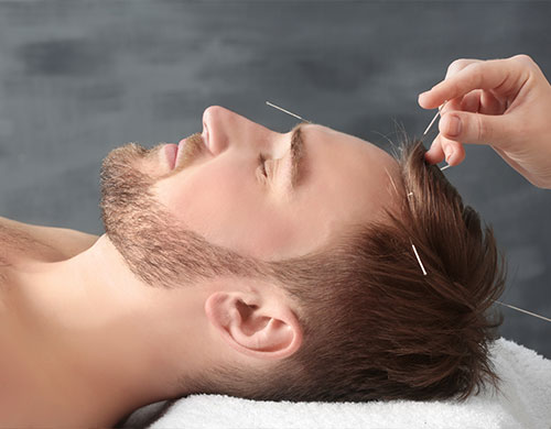 Acupuncture Specialist Near Me in Hoboken, NJ