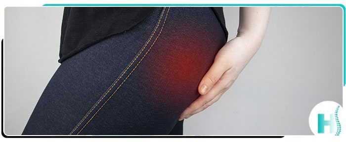 Sciatica Treatment Near Me in Hoboken, NJ