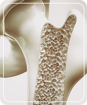 Osteoporosis Treatment Near Me in Hoboken NJ
