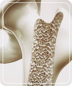Osteoporosis Treatment Near Me in Hoboken NJ
