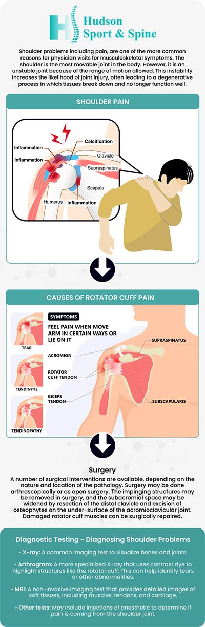 Common questions asked by patients: How do you treat shoulder pain? How do I know what type of shoulder pain I have? When should I be worried about shoulder pain? How long is too long for shoulder pain? For more information, contact us today or schedule an online appointment. We serve patients from Hoboken NJ, Jersey City NJ, Weehawken NJ, West New York NJ, Guttenberg NJ, Secaucus NJ, Harrison NJ, Kearny NJ, Newark NJ, Belleville NJ, North Bergen NJ and Lyndhurst NJ.