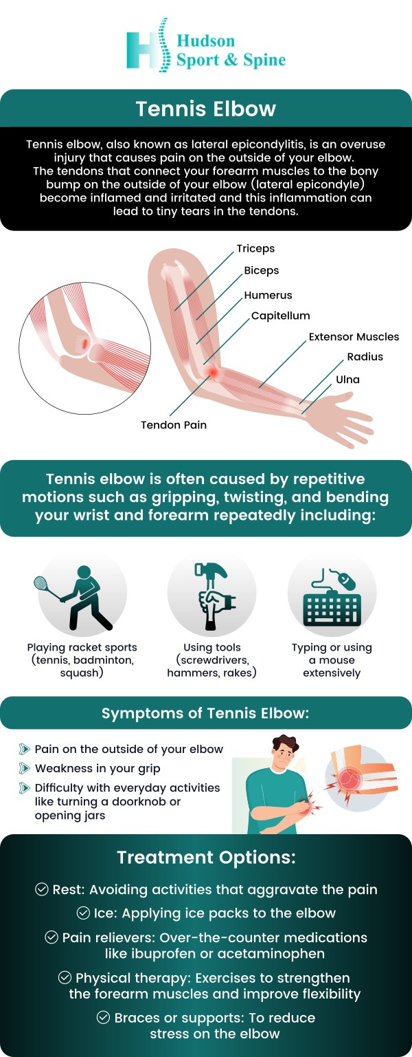 Common questions asked by patients: What is mistaken for tennis elbow? What is the best way to fix a tennis elbow? What triggers tennis elbow? What not to do with tennis elbow? For more information, contact us today or schedule an online appointment. We serve patients from Hoboken NJ, Jersey City NJ, Weehawken NJ, West New York NJ, Guttenberg NJ, Secaucus NJ, Harrison NJ, Kearny NJ, Newark NJ, Belleville NJ, North Bergen NJ and Lyndhurst NJ.