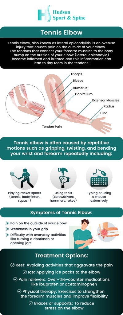 Common questions asked by patients: What is mistaken for tennis elbow? What is the best way to fix a tennis elbow? What triggers tennis elbow? What not to do with tennis elbow? For more information, contact us today or schedule an online appointment. We serve patients from Hoboken NJ, Jersey City NJ, Weehawken NJ, West New York NJ, Guttenberg NJ, Secaucus NJ, Harrison NJ, Kearny NJ, Newark NJ, Belleville NJ, North Bergen NJ and Lyndhurst NJ.