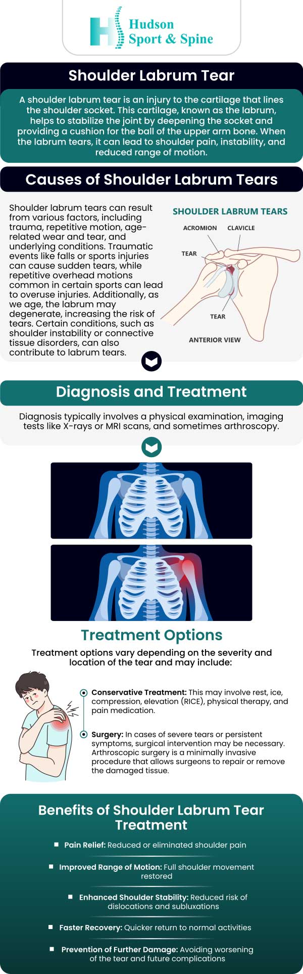 Common questions asked by our patients: What causes a labrum tear? What are the symptoms of a torn labrum? What are the non-surgical treatment options for labrum tears? What lifestyle changes should I make after labrum repair surgery? For more details please contact us or book an appointment online. We serve patients from Hoboken NJ, Jersey City NJ, Weehawken NJ, West New York NJ, Guttenberg NJ, Secaucus NJ, Harrison NJ, Kearny NJ, Newark NJ, Belleville NJ, North Bergen NJ and Lyndhurst NJ.