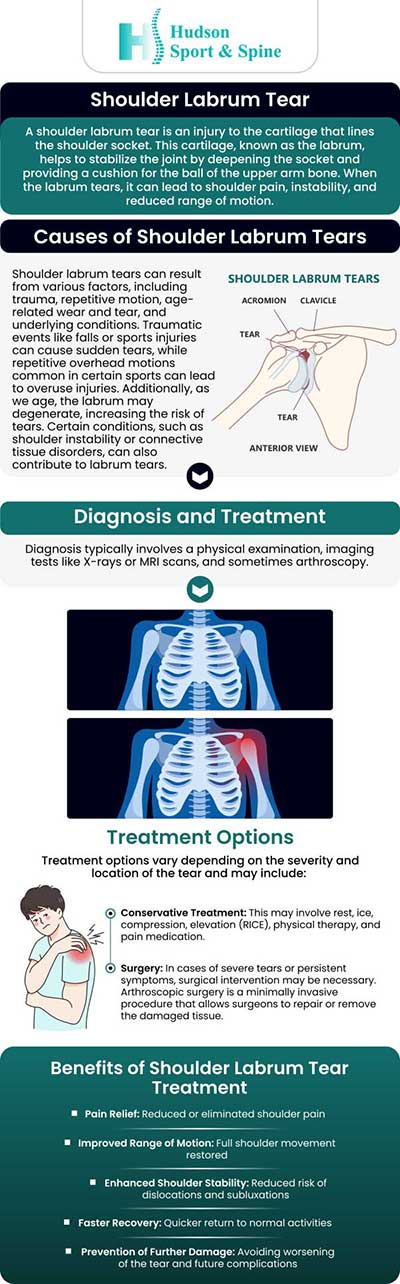 Common questions asked by our patients: What causes a labrum tear? What are the symptoms of a torn labrum? What are the non-surgical treatment options for labrum tears? What lifestyle changes should I make after labrum repair surgery? For more details please contact us or book an appointment online. We serve patients from Hoboken NJ, Jersey City NJ, Weehawken NJ, West New York NJ, Guttenberg NJ, Secaucus NJ, Harrison NJ, Kearny NJ, Newark NJ, Belleville NJ, North Bergen NJ and Lyndhurst NJ.