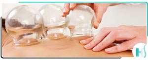 Cupping Therapy Clinic Near Me in Hoboken NJ