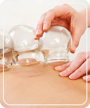 Cupping Near Me in Hoboken NJ