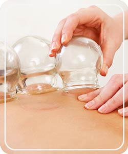 Cupping Near Me in Hoboken NJ