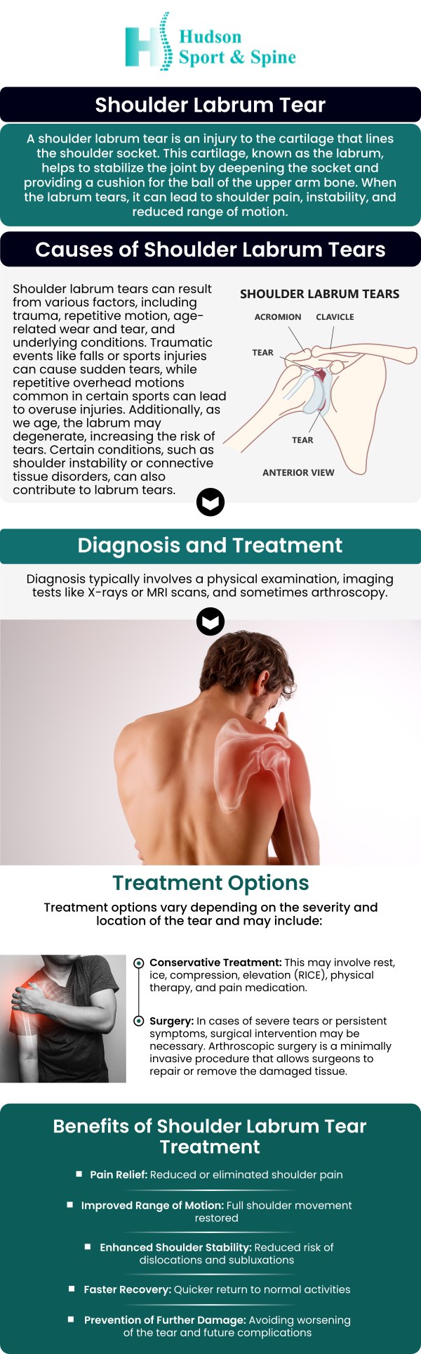 Common questions asked by our patients: What causes a labrum tear? What are the symptoms of a torn labrum? What are the non-surgical treatment options for labrum tears? What lifestyle changes should I make after labrum repair surgery? What non-surgical treatments does Dr. Todd Givens, DC, at Hudson Sport & Spine, provide for labrum injuries? For more details please contact us or book an appointment online. We serve patients from Hoboken NJ, Jersey City NJ, Weehawken NJ, West New York NJ, Guttenberg NJ, Secaucus NJ, Harrison NJ, Kearny NJ, Newark NJ, Belleville NJ, North Bergen NJ and Lyndhurst NJ.
