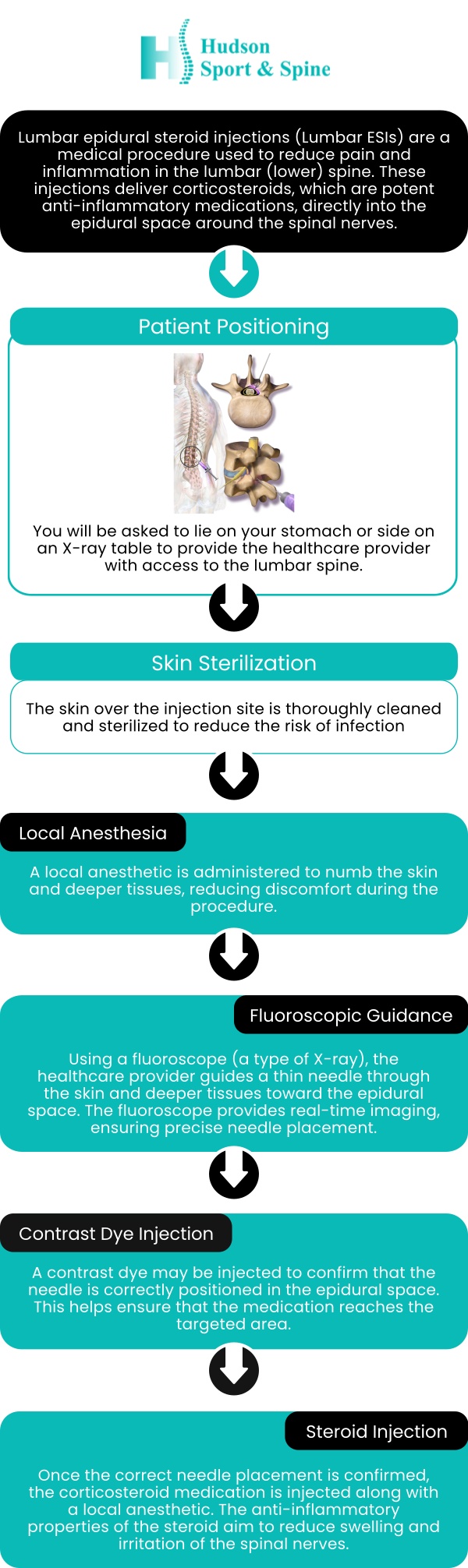 If you're considering an epidural steroid injection for your back pain, Dr. Todd Given, DC, at Hudson Sport & Spine offers expert consultations to help determine if this treatment is right for you. With his in-depth knowledge of spinal health, Dr. Givens evaluates your condition and discusses the benefits and risks of epidural steroid injections as part of your personalized pain management plan. Contact us for more information or book an appointment online today. We are conveniently located at 70 Hudson St Suite 2B, Hoboken, NJ 07030. If you're considering an epidural steroid injection for your back pain, Dr. Todd Given, DC, at Hudson Sport & Spine offers expert consultations to help determine if this treatment is right for you. With his in-depth knowledge of spinal health, Dr. Givens evaluates your condition and discusses the benefits and risks of epidural steroid injections as part of your personalized pain management plan. Contact us for more information or book an appointment online today. We are conveniently located at 70 Hudson St Suite 2B, Hoboken, NJ 07030.