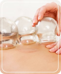 Cupping Near Me in Hoboken NJ